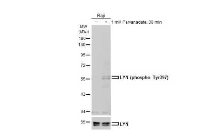 Western Blot: Lyn [p Tyr397] Antibody [NBP3-12926]